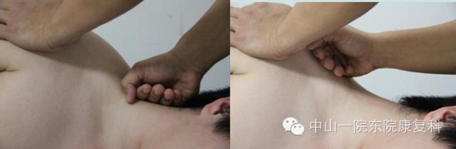 康复治疗技术人体解剖学,12条筋膜链解析及治疗手法