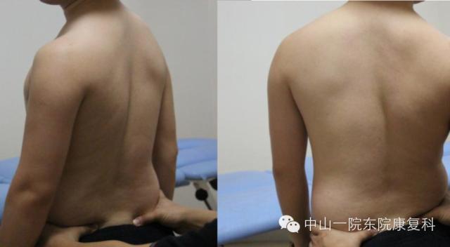 康复治疗技术人体解剖学,12条筋膜链解析及治疗手法