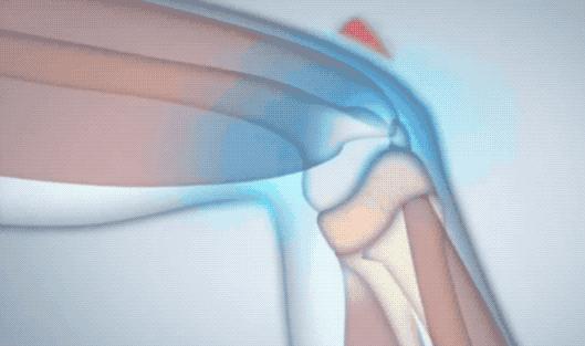 腰酸背痛、肩颈酸乏、肌肉疲劳?德国人有个家喻户晓的妙招||Chin@美物