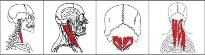 看起来虎背熊腰但是并不胖怎么办,为什么感觉自己看起来虎背熊腰