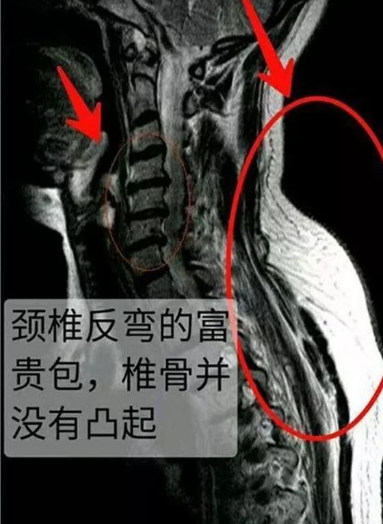 看起来虎背熊腰但是并不胖怎么办,为什么感觉自己看起来虎背熊腰