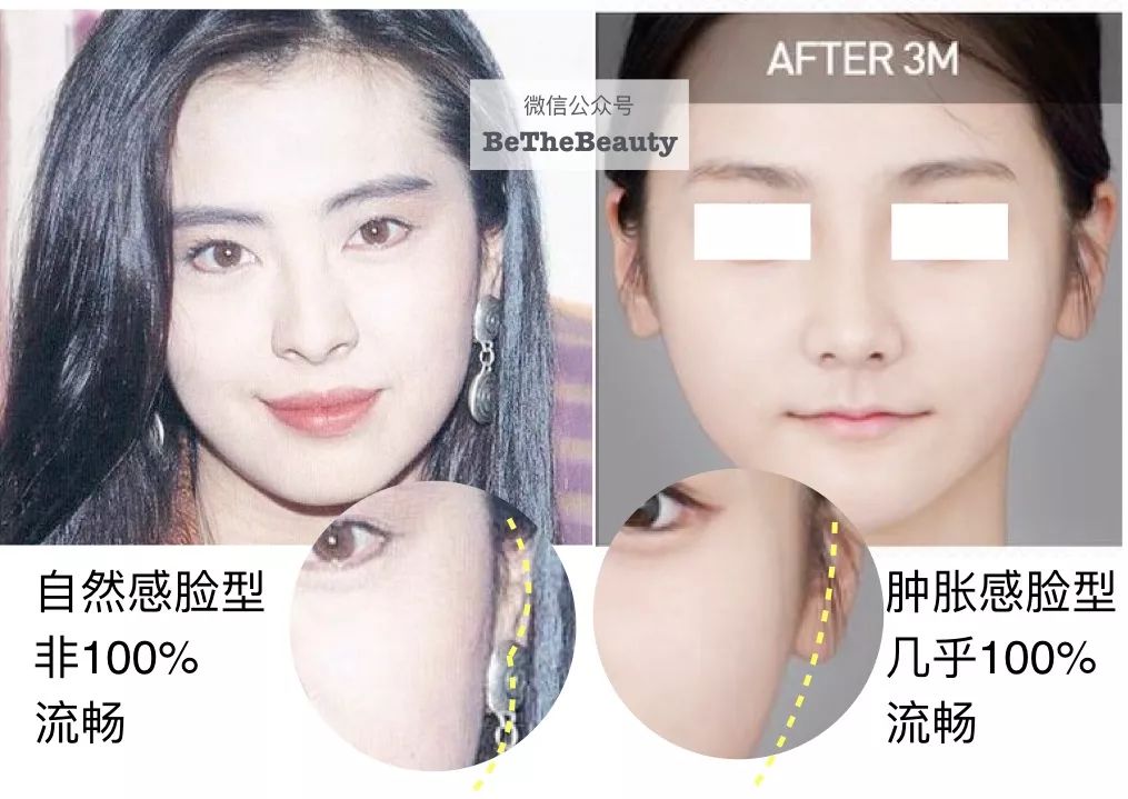 标准精致的脸属于什么脸型,什么样的脸型算是帅气的脸型