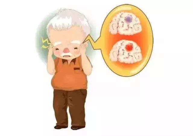 脑出血病人出院后如何食疗,倪海厦脑出血治疗处方