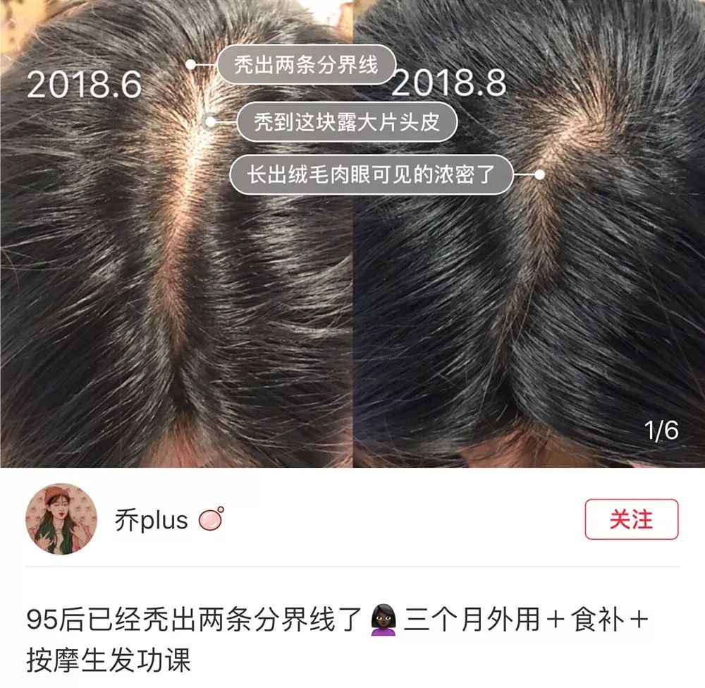 一根头发价值,一根头发值一万