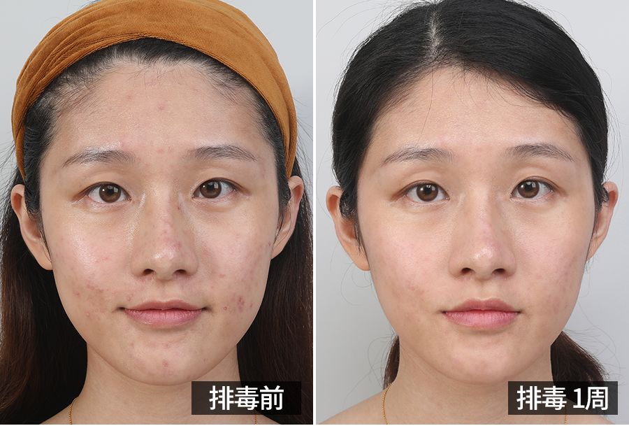 大长今金喜善宋慧乔,39岁宋慧乔完美复出御姐范十足