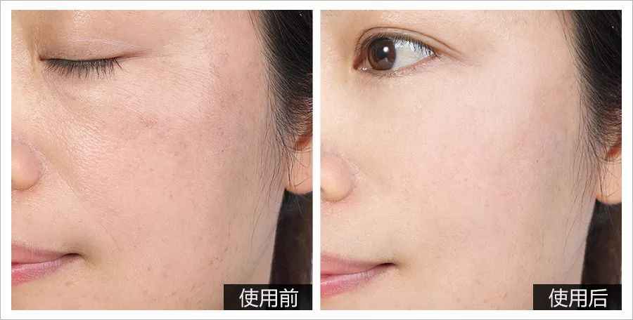 大长今金喜善宋慧乔,39岁宋慧乔完美复出御姐范十足