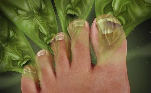 也许你没去过香港,但你一定听说过“香港脚”