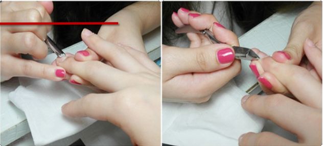 灰指甲美甲处理,灰指甲霉菌感染致癌