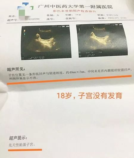 「女科荟」18岁的女孩身材还矮小，为什么？