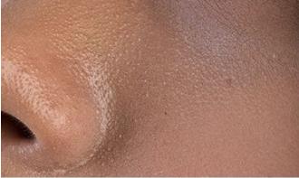 柔嫩抛光|脸上搓出3斤泥!难怪又黄又暗又黑头!10秒给脸蛋“剥壳”,厉害