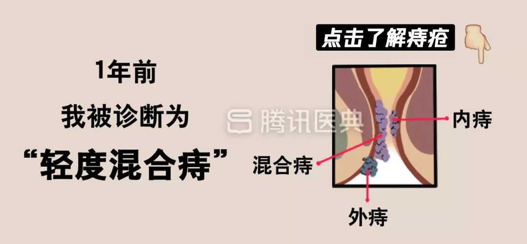“*菊爆**后”痛到喊妈！真实看病经历泣血奉上，必须保护好菊花！