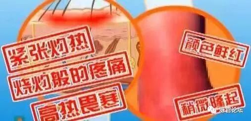 足癣丹毒是怎样引起的,痛风丹毒