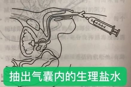 护士着急救人,护士及时发现问题改正叫什么行为