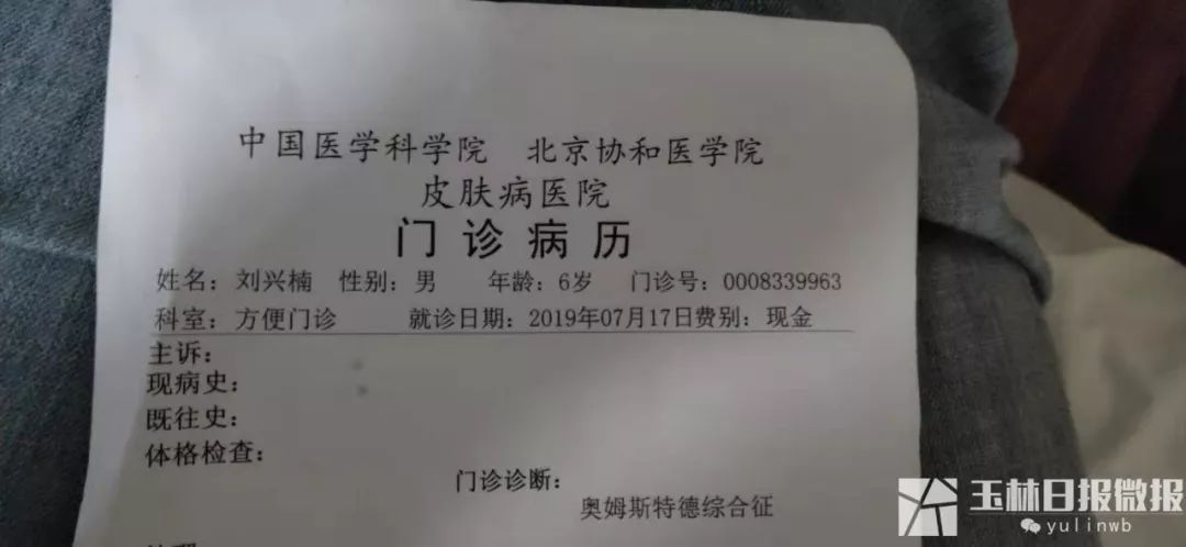 容县太和村小男孩硬皮病治好没有,容县树皮男孩后续