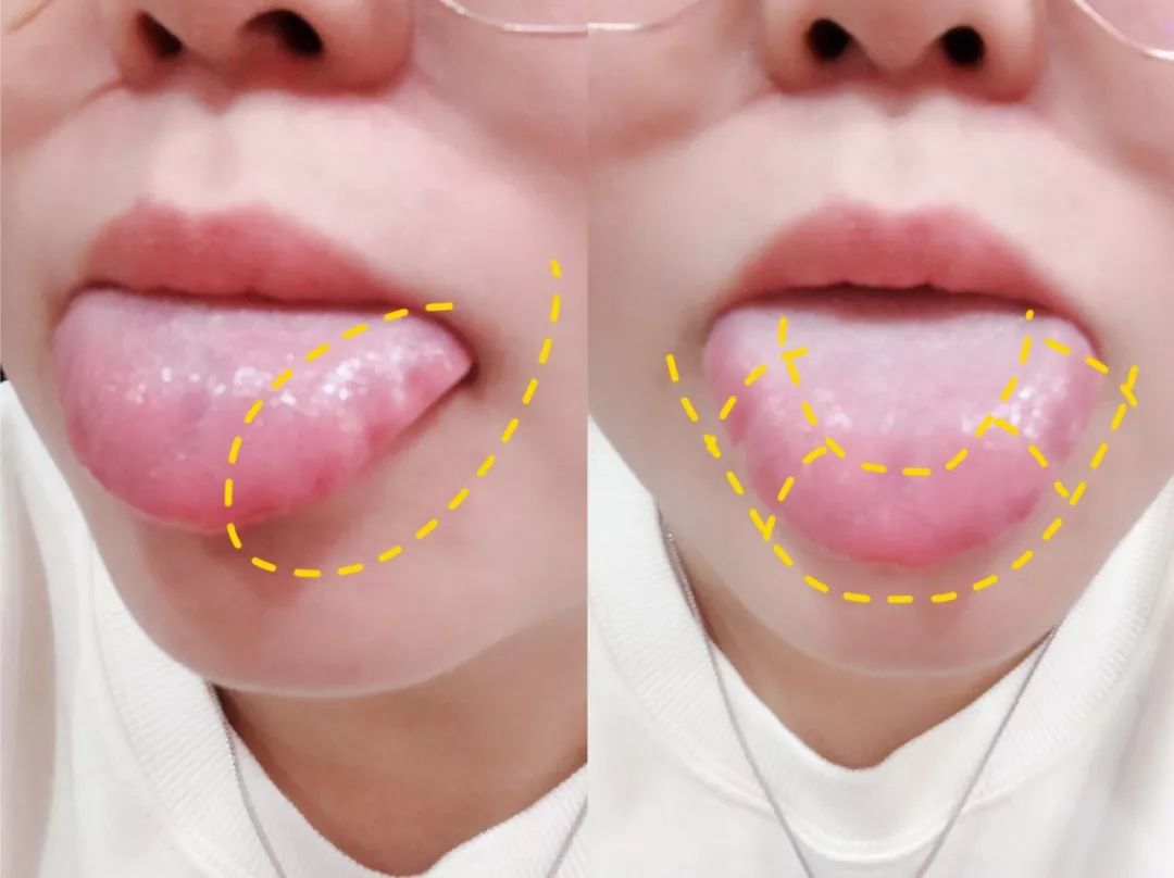 真人秀遇生理期也能撒狗粮,“多喝热水”竟成送命答案