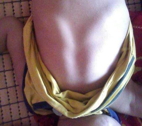 宝宝有轻微鸡胸怎么办,宝宝出现鸡胸是缺什么