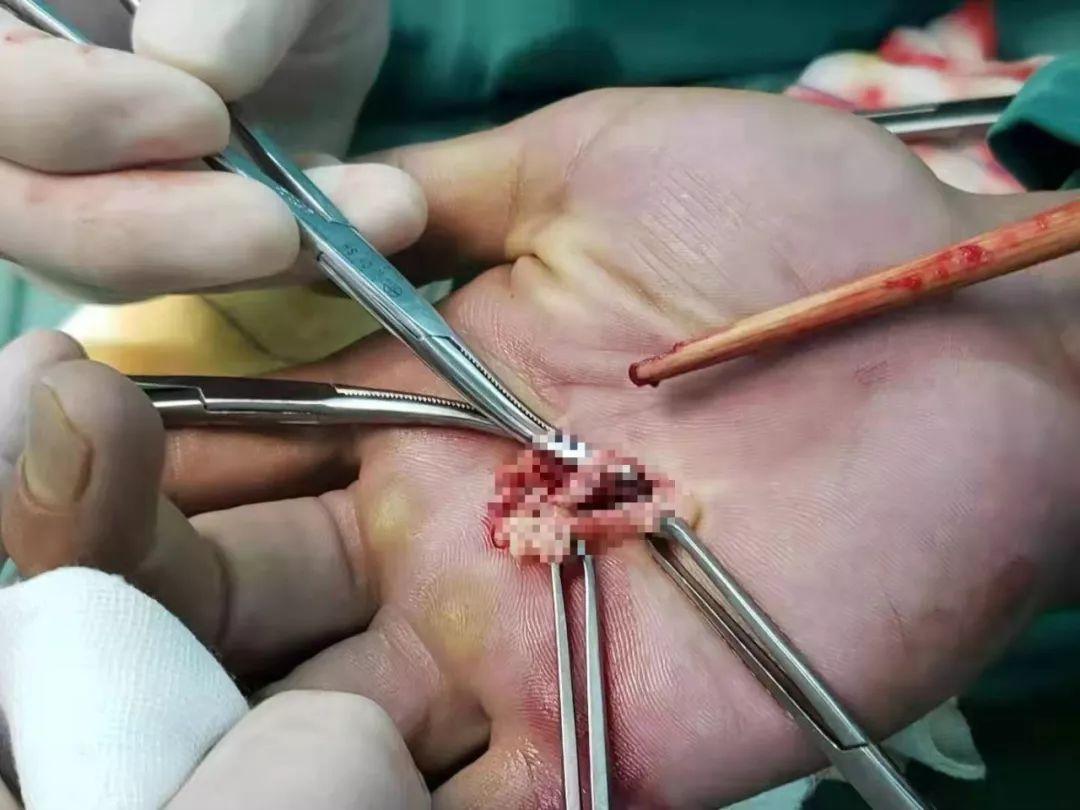 跟风模仿视频,跟风效仿的坏处