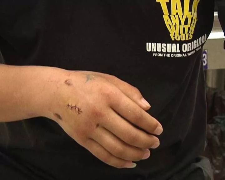 跟风模仿视频,跟风效仿的坏处