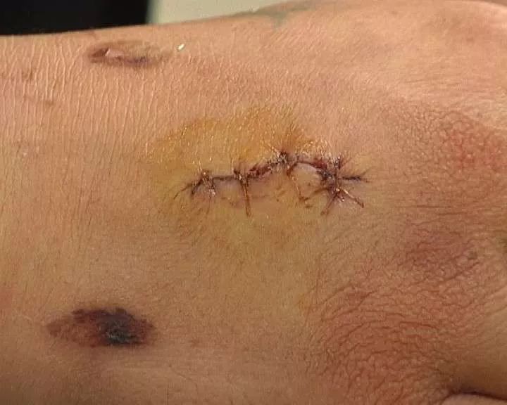 跟风模仿视频,跟风效仿的坏处