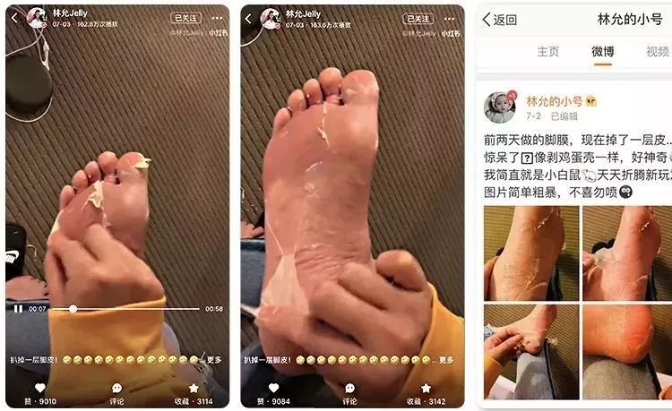 娇嫩双足|堪比“换皮术”的逆天足膜！让双脚像剥鸡蛋壳一样轻松换新皮！60分钟还你柔嫩美足