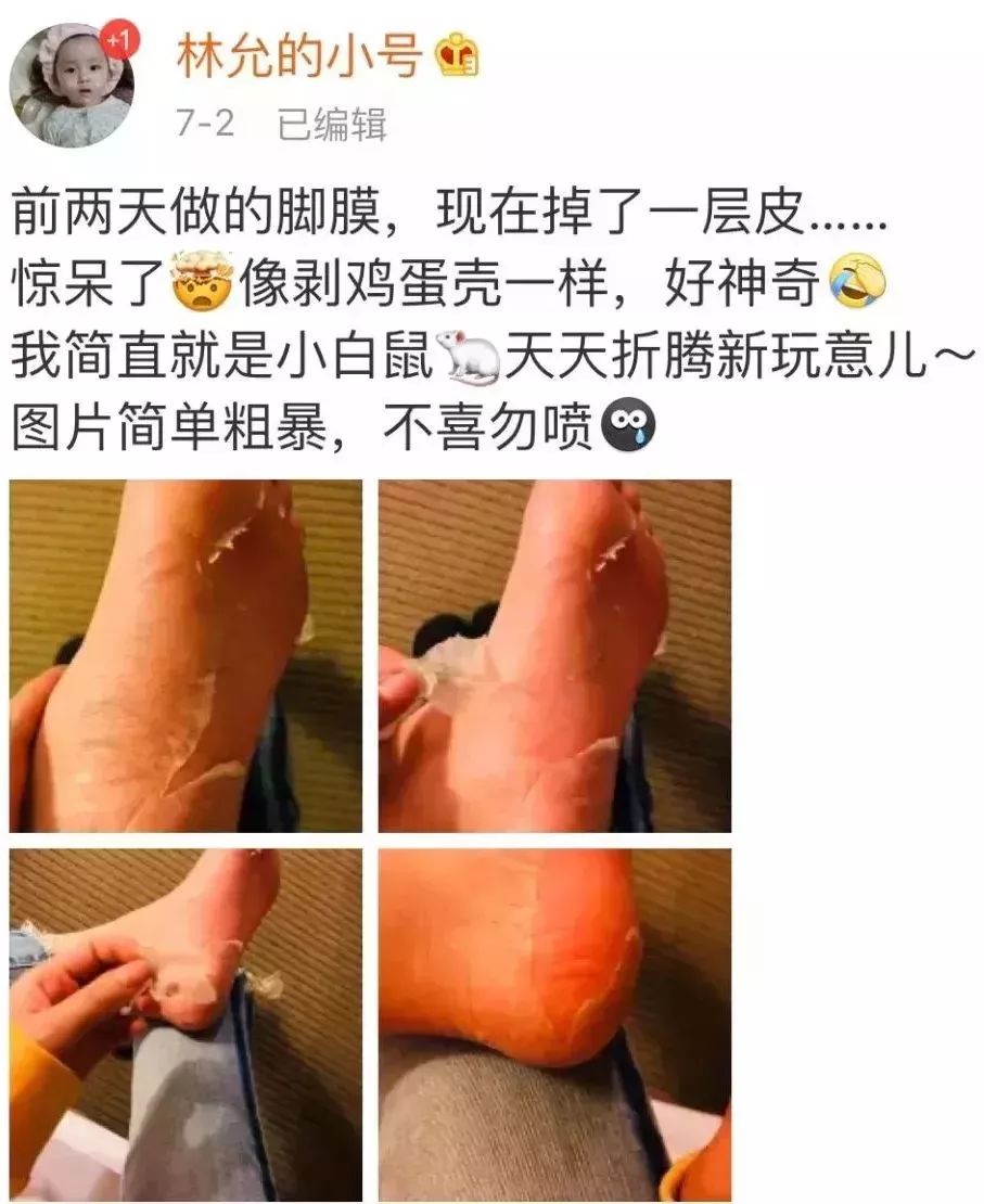 娇嫩双足|堪比“换皮术”的逆天足膜！让双脚像剥鸡蛋壳一样轻松换新皮！60分钟还你柔嫩美足