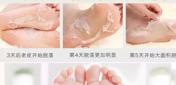 娇嫩双足|堪比“换皮术”的逆天足膜！让双脚像剥鸡蛋壳一样轻松换新皮！60分钟还你柔嫩美足