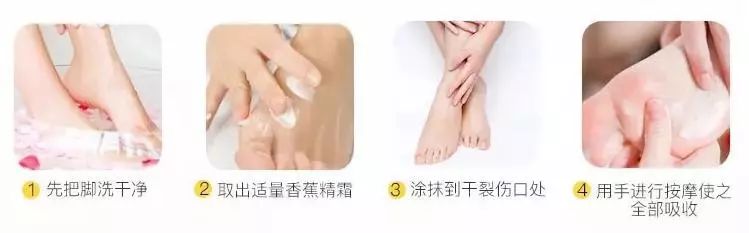 治脚气的抗真菌偏方,角化型脚气干裂最好的药