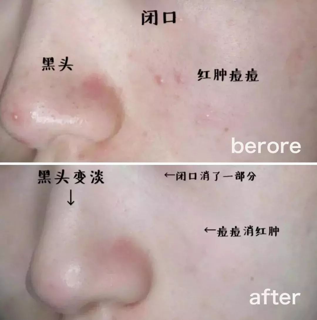 带有修护力且清爽不黏腻的精华,好用的新西兰精华液