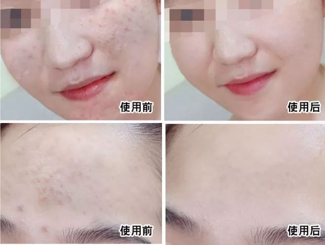 带有修护力且清爽不黏腻的精华,好用的新西兰精华液