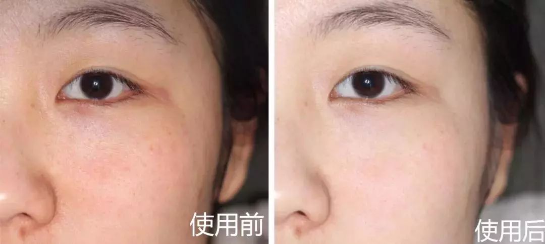 带有修护力且清爽不黏腻的精华,好用的新西兰精华液