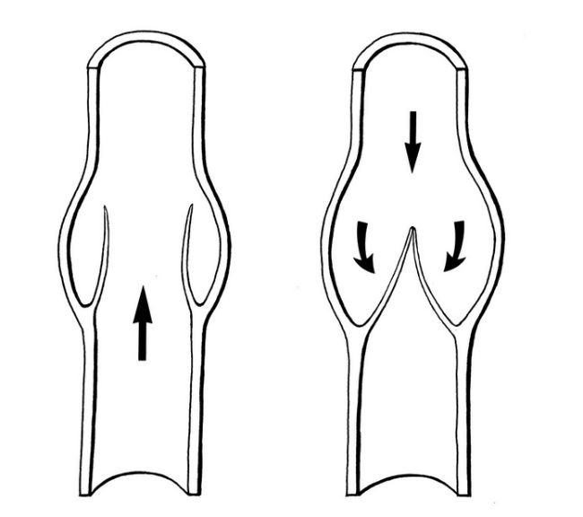 涂磊身上有静脉曲张吗,涂磊自曝腿部有静脉曲张