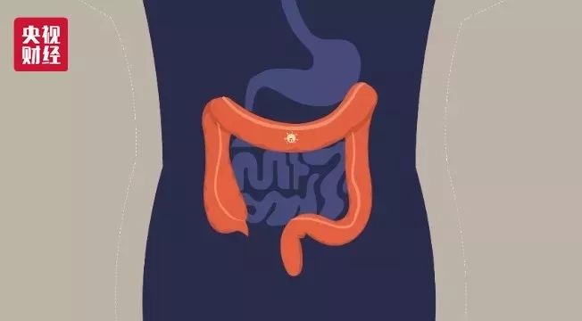 肺癌、胃癌、肝癌,如何体检才能早发现八大高发癌症?