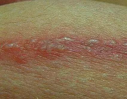 牙疼带的太阳穴疼挂啥科看,牙疼和眼疼看什么科