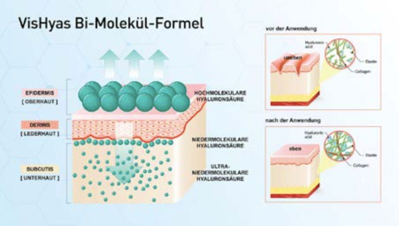 vishya玻尿酸德国价格,玻尿酸水光抗皱抚纹霜