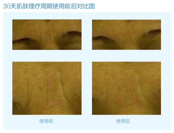 vishya玻尿酸德国价格,玻尿酸水光抗皱抚纹霜