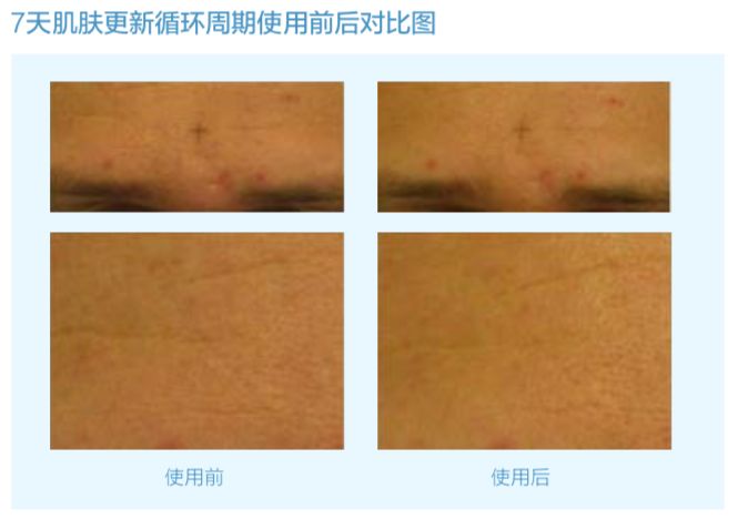 vishya玻尿酸德国价格,玻尿酸水光抗皱抚纹霜