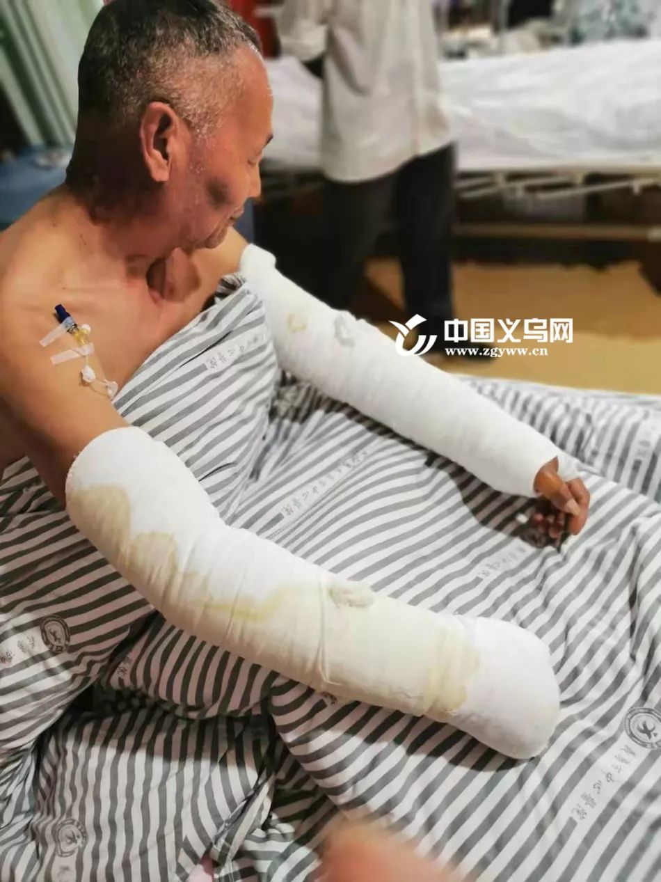 义乌城西着火最新消息,村民家中起火干群已紧急扑救