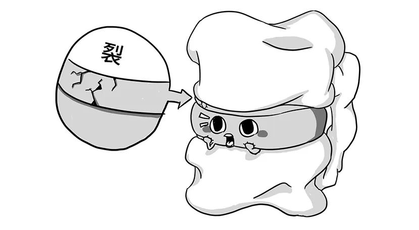 颈椎腰椎间盘突出最快的恢复办法,腰椎间盘突出这么痛怎么能缓解呢