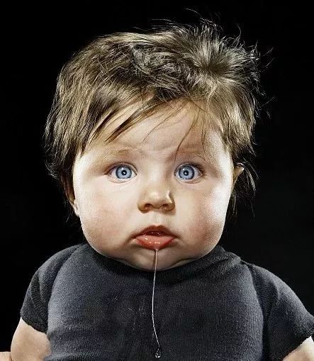 一掌拍在了图钉上,该怎么办|周末涨知识