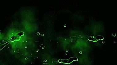 生活中有哪些常见凶险的致病菌,非常危险的致病菌有哪些