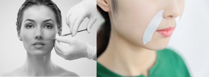 消除眉间法令纹最有效的方法,眉间纹和法令纹医美