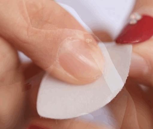 消除眉间法令纹最有效的方法,眉间纹和法令纹医美