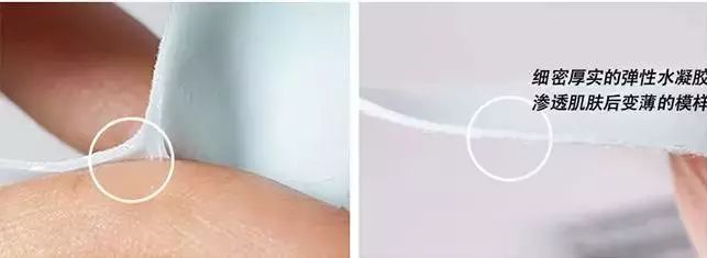 消除眉间法令纹最有效的方法,眉间纹和法令纹医美