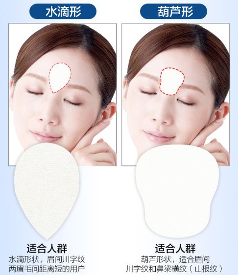 消除眉间法令纹最有效的方法,眉间纹和法令纹医美