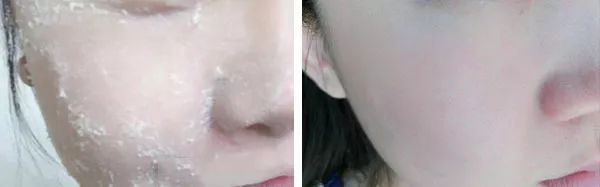 断货半年，抢都抢不到！荣登Cosme榜首，用完肌肤嫩到爆