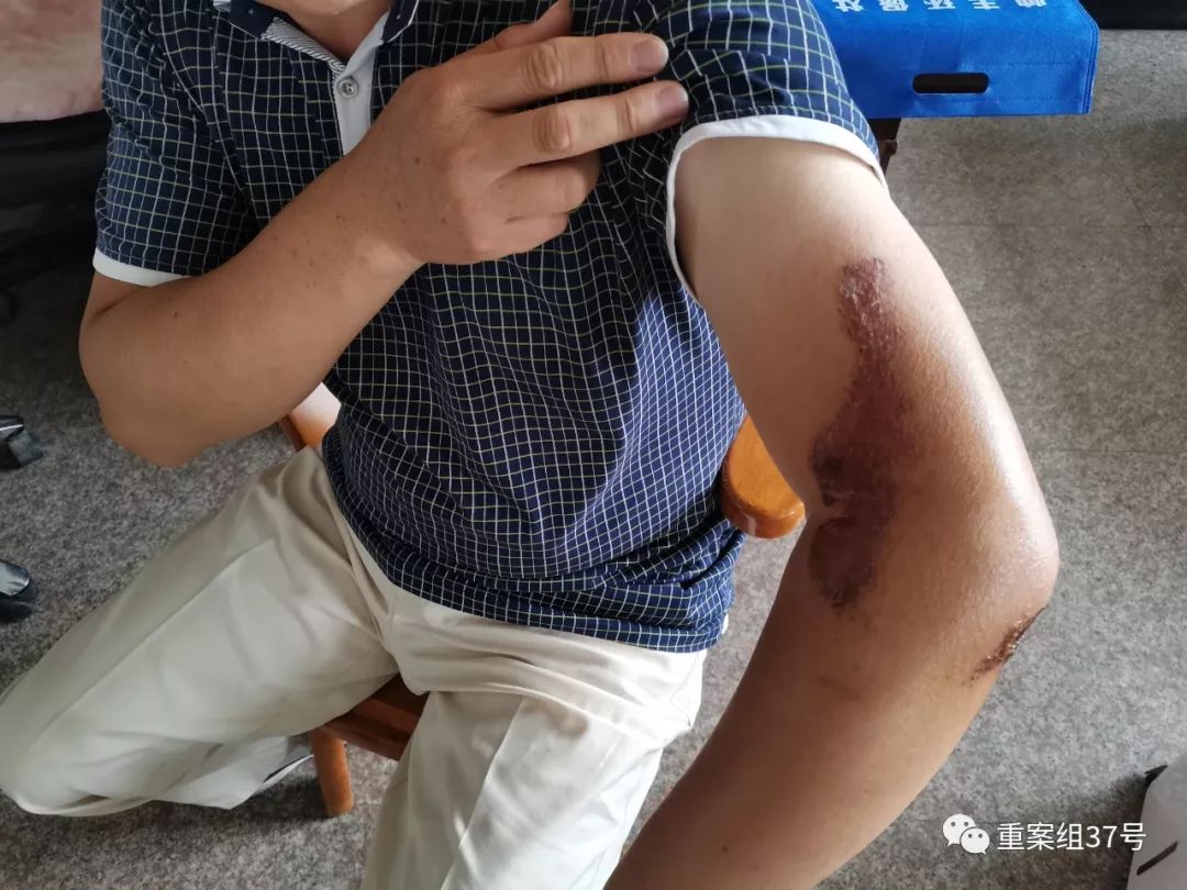 浙江龙泉企业家举报路上被撞背后,多家民企身陷借贷联保漩涡