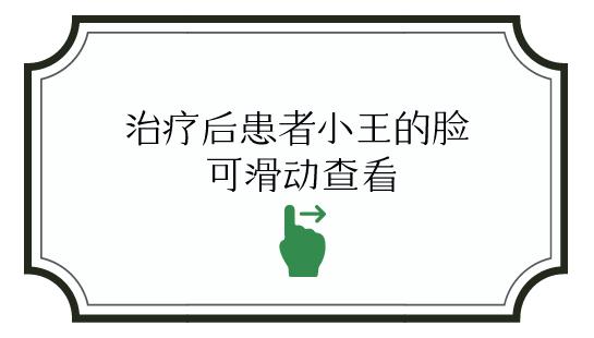 玉颜阁能祛痘痘吗,玉颜阁治什么病最好