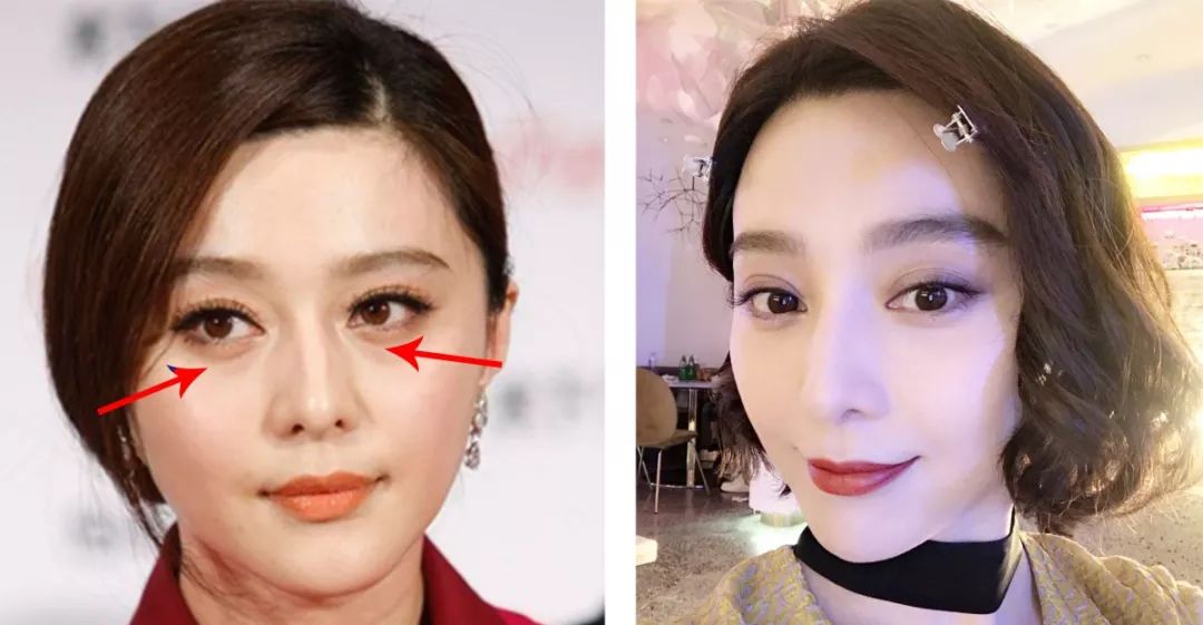 4成抗衰老眼霜抗衰老功效并不显著，同样功效的眼霜价格竟相差7倍？小鱼抗衰老眼霜绿鱼榜单为你揭晓