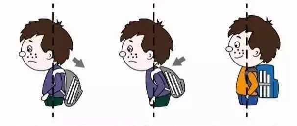背背佳矫正驼背书包,驼背书包怎么挑选