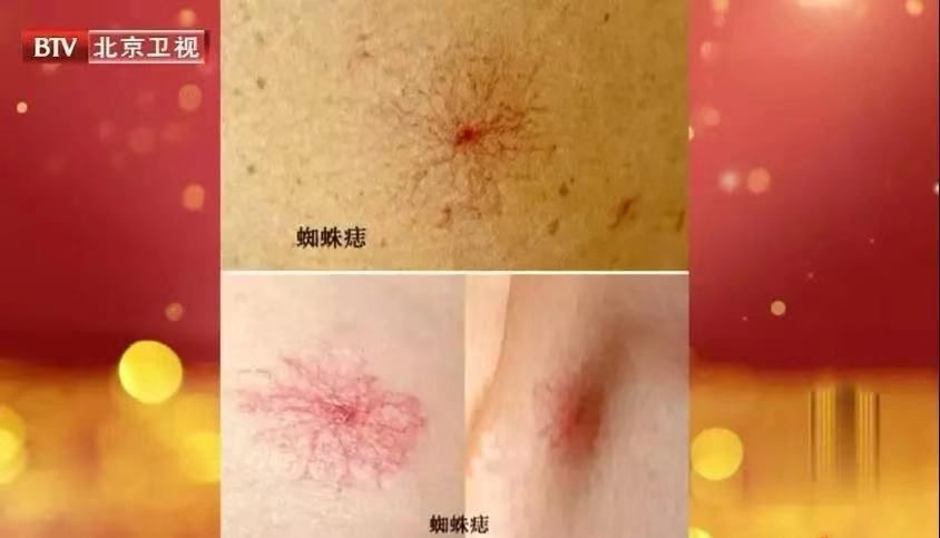 女人肚子为什么容易长赘肉,女性为什么那么容易长肚子